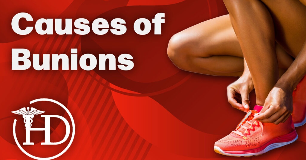 Bunions: Causes, Symptoms, Treatment Options, And The Role Of Clinical ...