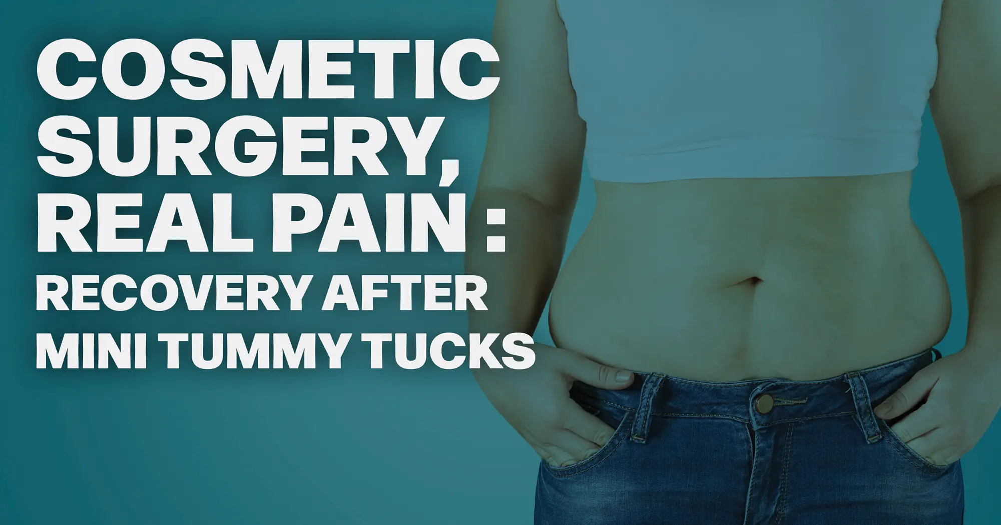Cosmetic Surgery, Real Pain – Recovery After Mini Tummy Tucks